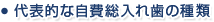代表的な自費総入れ歯の種類