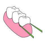 フロス
