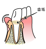 位相差顕微鏡検査