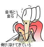 位相差顕微鏡検査