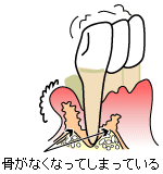 位相差顕微鏡検査